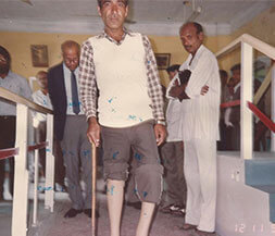 achalamoulik.com-prosthetic-centre